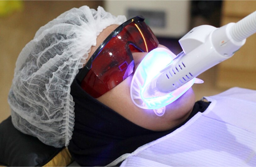 TEKNOLOGI-WHITENING